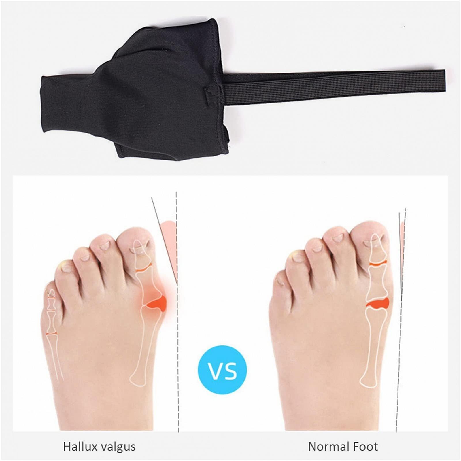 Випрямляч для великого пальця стопи, роздільник, подушечка для корекції вальгусної деформації, фото №7