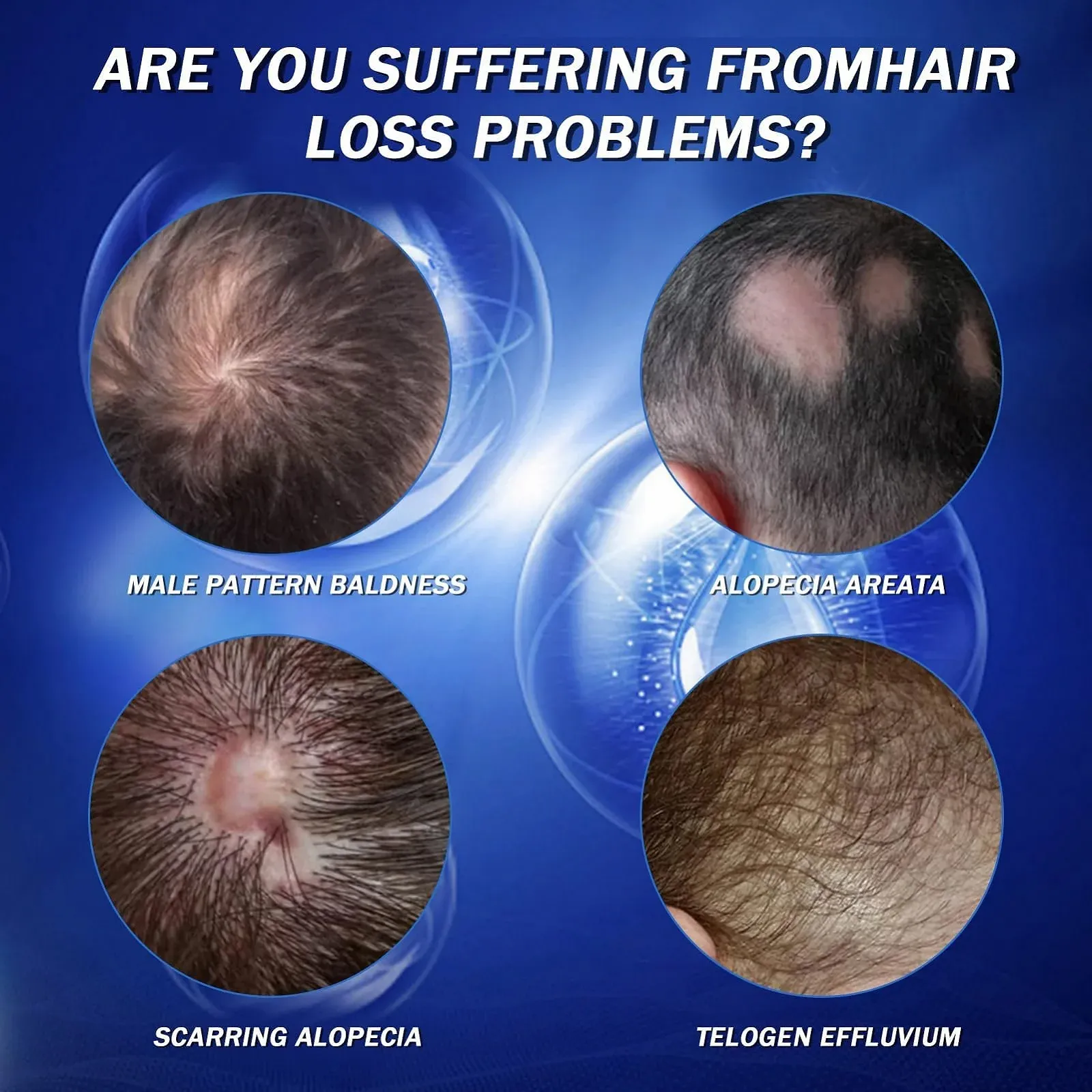 Сироватка для росту волосся з роликом 0,5 мм, сироватка проти випадіння волосся, фото №3 Сироватка для росту волосся з роликом 0,5 мм, сироватка проти випадіння волосся, фото №3