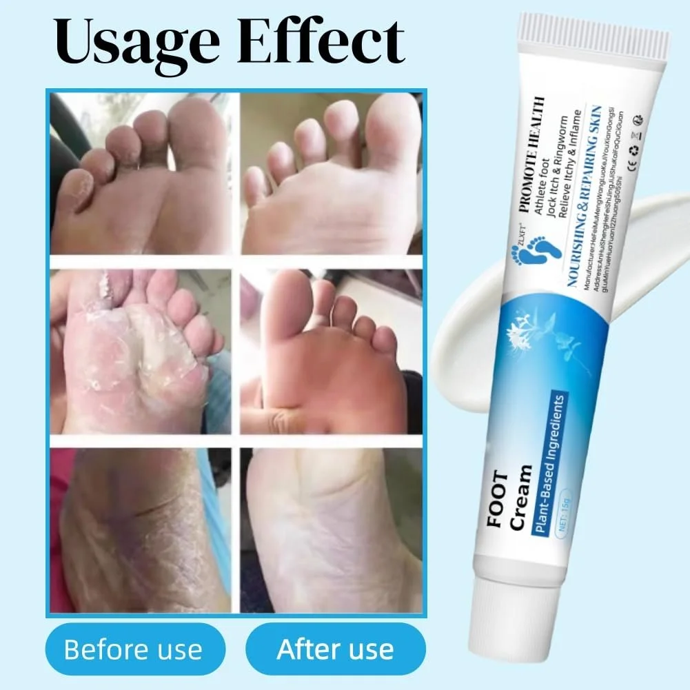 Гель від грибка стопи 2 шт. проти свербіння та неприємного запаху, фото №5