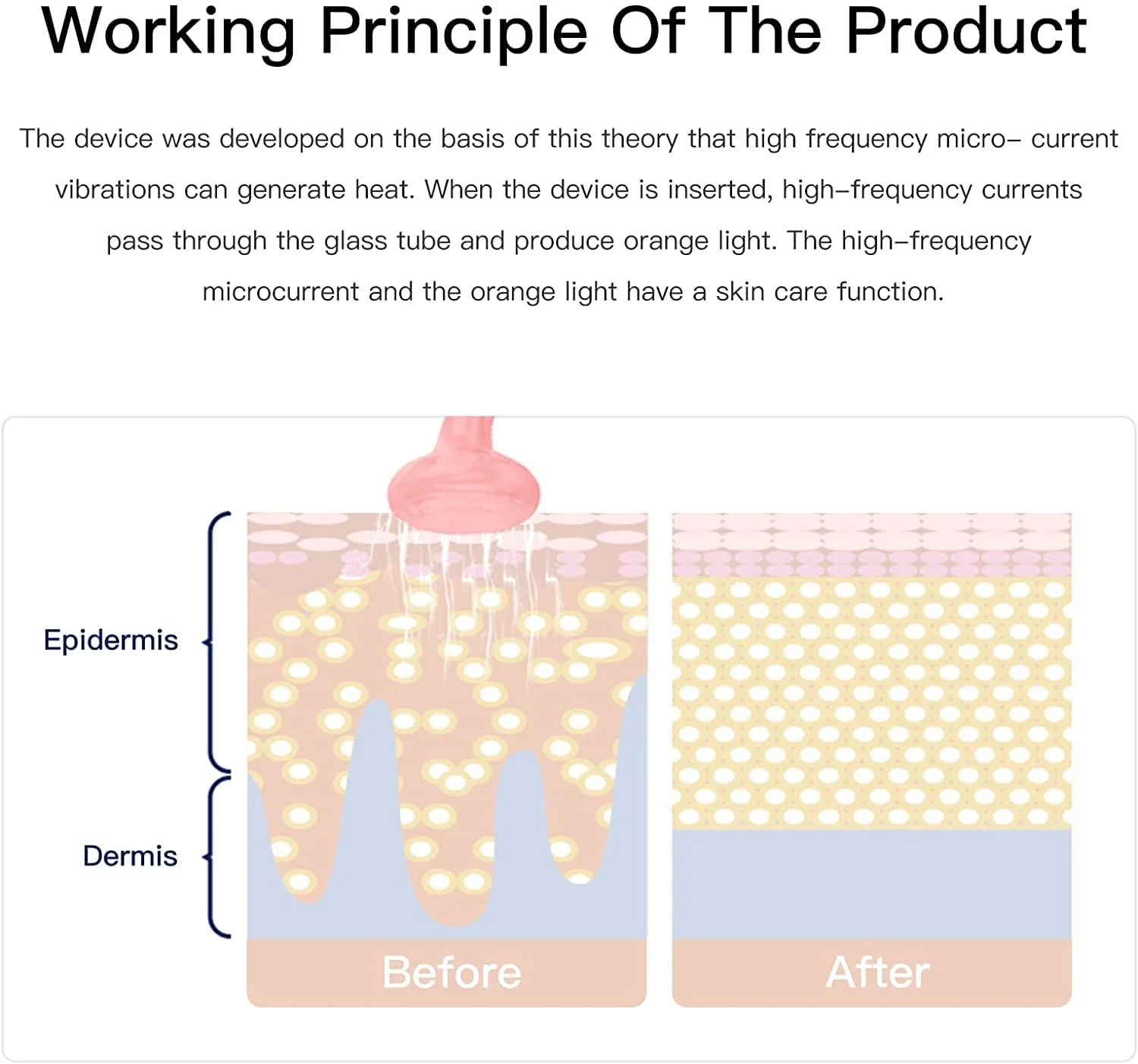 Высокочастотный прибор для лица с 4 электродами, фото №7