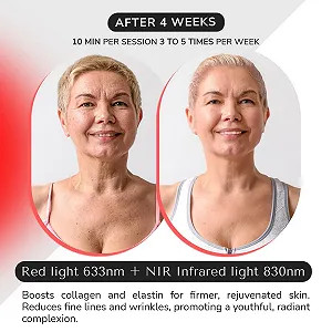 LED Маска для лица ODELYNE AdaraPRO с инфракрасным и красным светом 830 нм, 4 длины волн (415-830 нм), 432 светодиода synthetic.ua - Фото 1