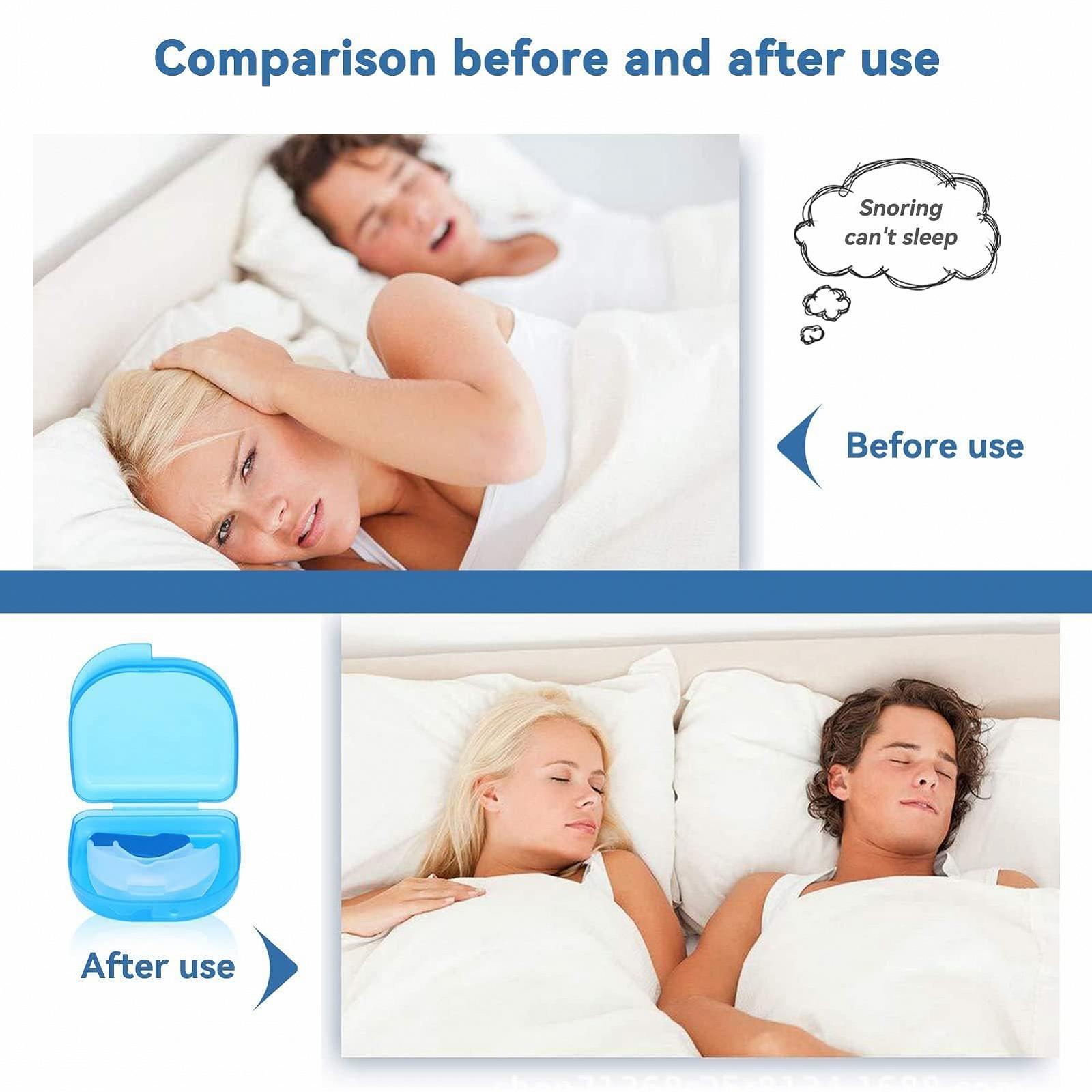 Засіб від хропіння Agatige, Захисна капа, фото №4 Засіб від хропіння Agatige, Захисна капа, фото №4