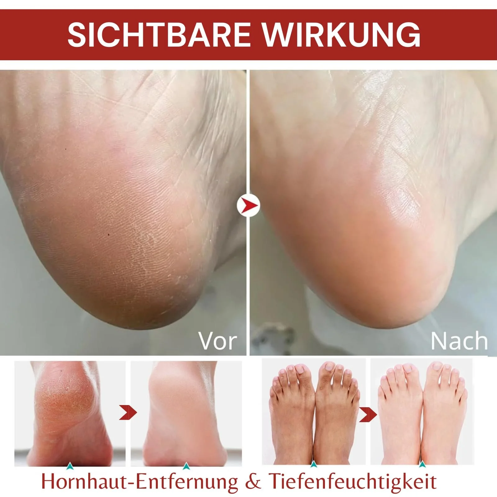 Крем для ног Увлажняющий против трещин и мозолей Набор 2 шт. с мочевиной 60% для пяток, рук и локтей, фото №4