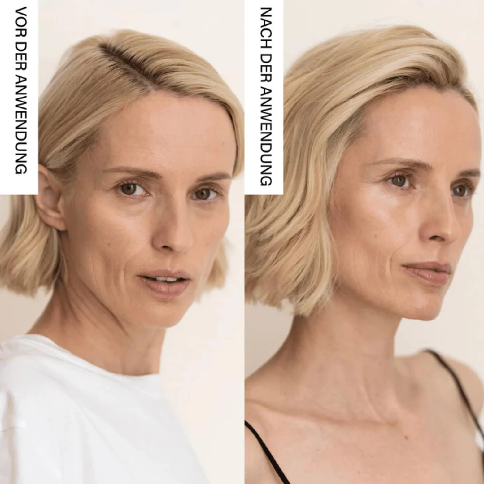 LED Маска Rosental Organics для лица – профессиональная световая терапия для замедления старения, фото №2