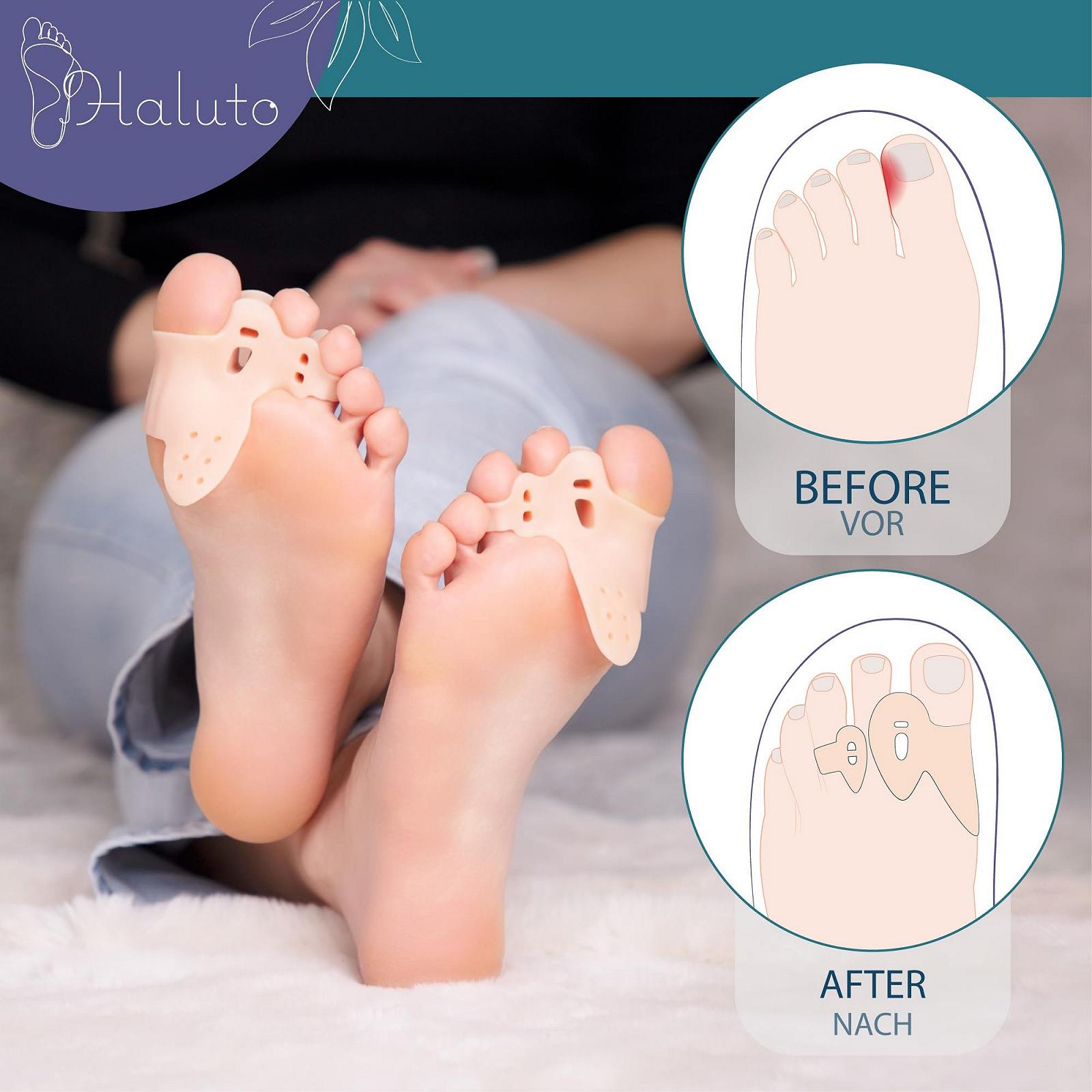 Роздільник для великого пальця ноги HALUTO, 3 пари / 6 штук, силіконовий, фото №6