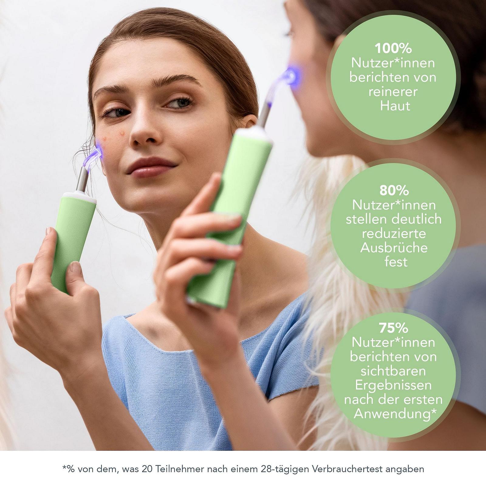 Пристрій для догляду за шкірою FOREO ESPADA 2 Plus Precise, Targeted LED - для лікування плям - медичний силікон - Pistachio, фото №5