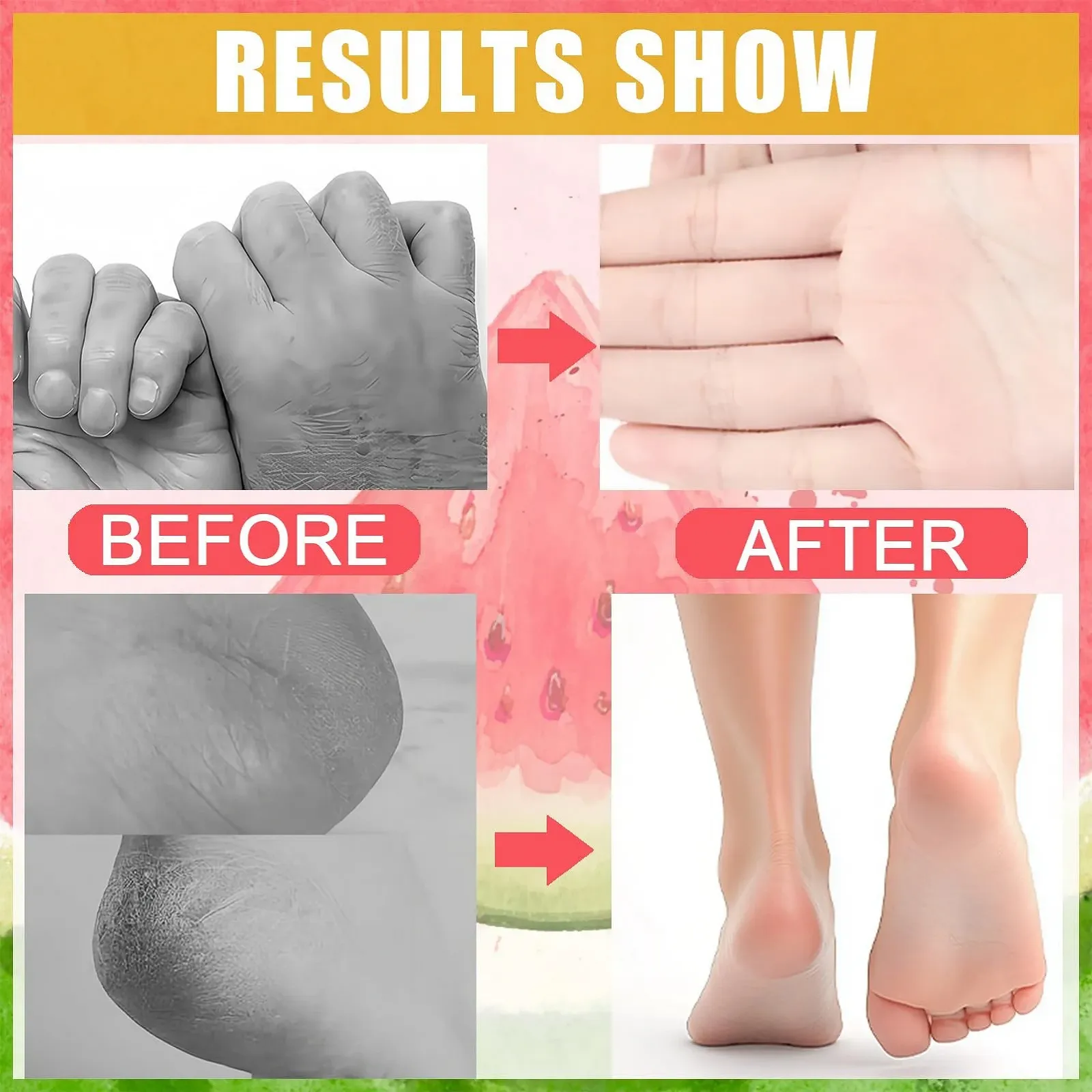 Увлажняющий крем для ног Watermelon от мозолей стик 1.41 унции (40 г), фото №3