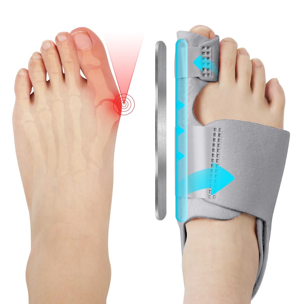 Шина для корекції Hallux Valgus ACWOO, 2 шини для корекції та 2 роздільники для пальців, нековзний, фото №1