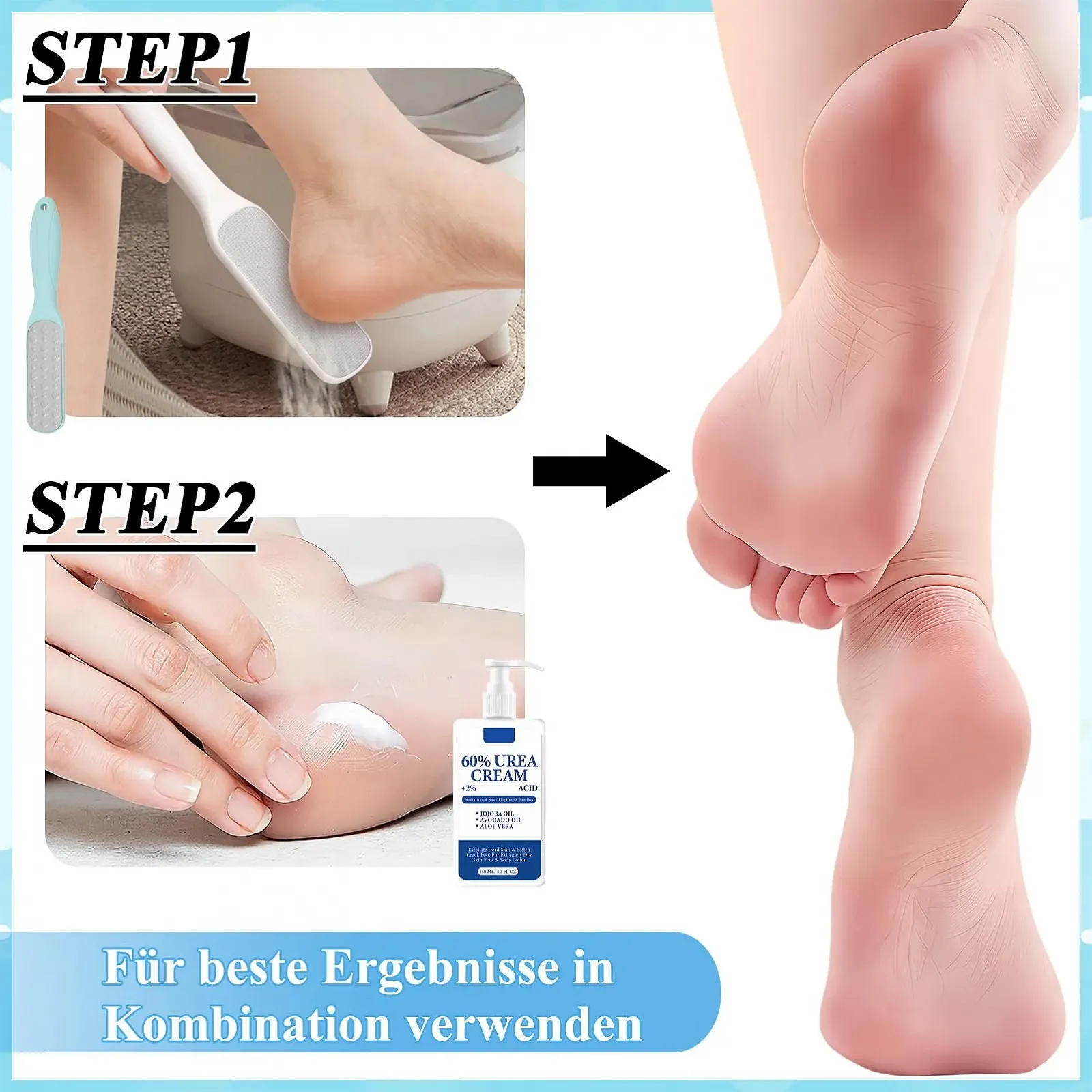 Увлажняющий крем для ног с 60% мочевиной, 150 мл, фото №7