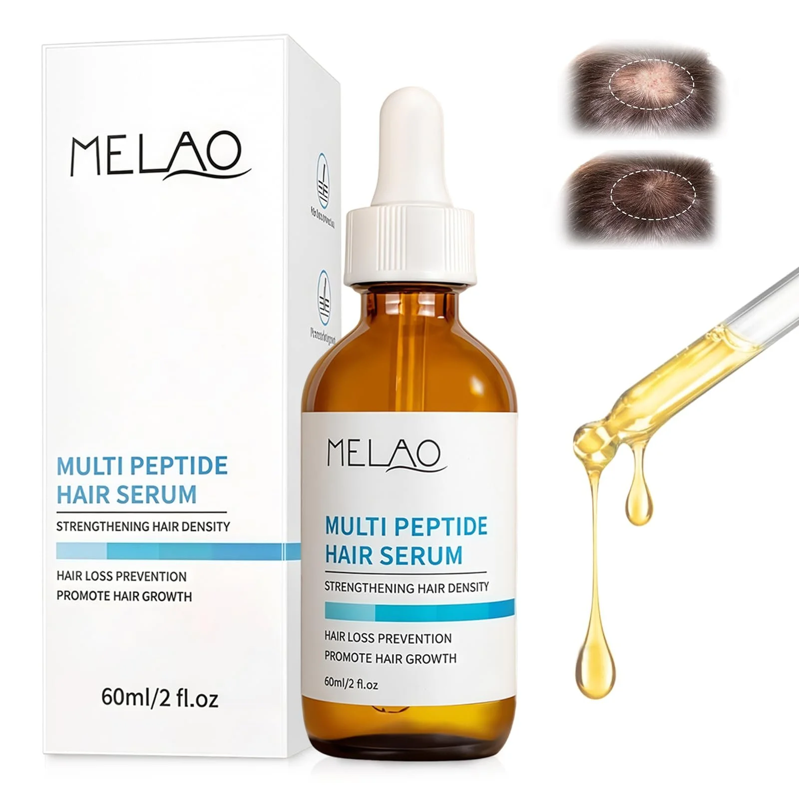 Сыворотка для роста волос для мужчин и женщин, средство для контроля выпадения волос, ускоряет рост волос, масло для густых волос, сыворотка для питания кожи головы, фото №1