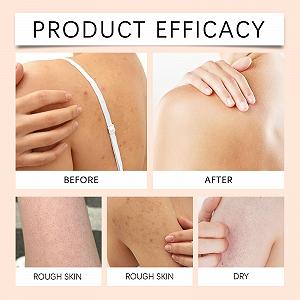 Гель для душу Papaya Whitening з ефектом пілінгу та відбілювання для темної шкіри synthetic.ua - Фото 1