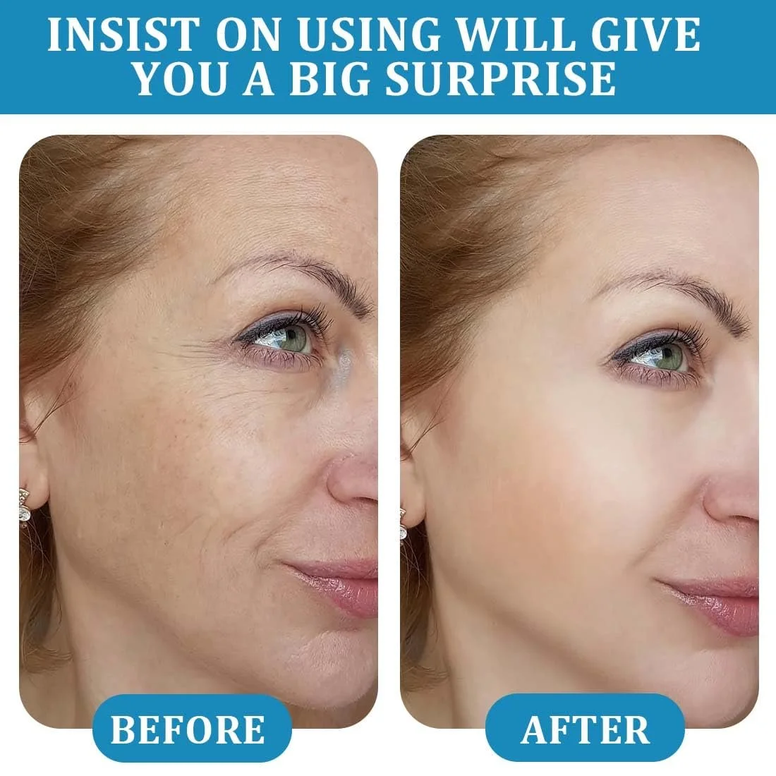 Набір Micro Infusion System, Micro Infusion System для обличчя, Beauty Micro Infusion Needling Kit, глибоке зволоження, фото №3