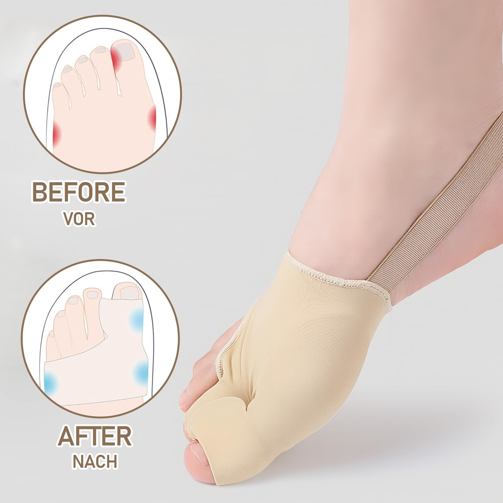 Пов'язка Hallux Valgus 2 пари, Зручна та дихаюча корекція Hallux Valgus, Ергономічний дизайн адаптується до стопи, Унісекс, фото №3