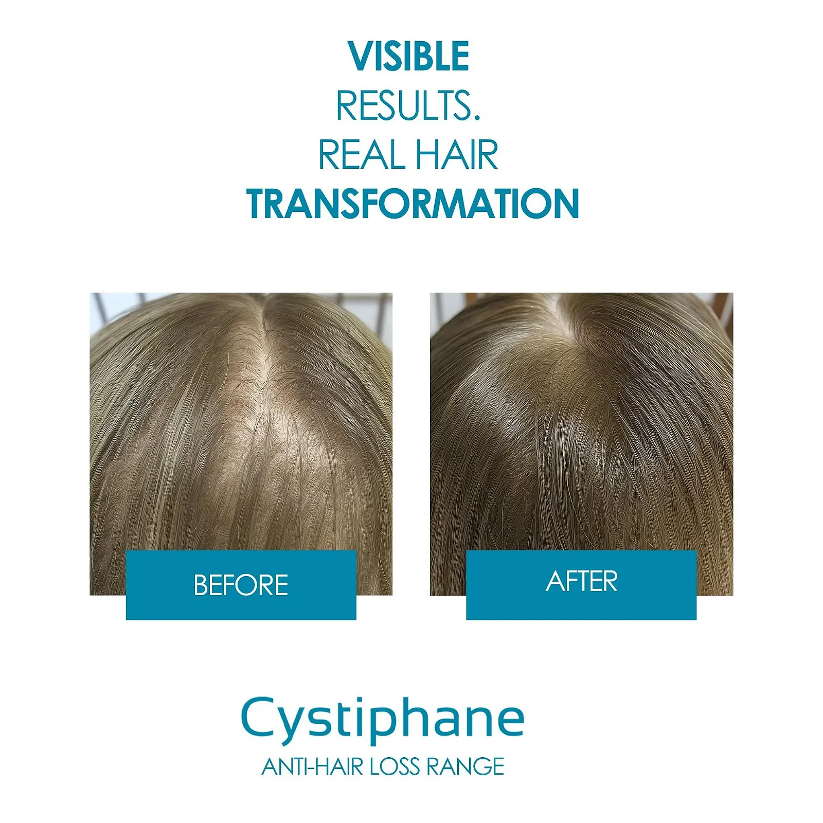 Лосьон против выпадения волос Cystiphane 125 мл, фото №7