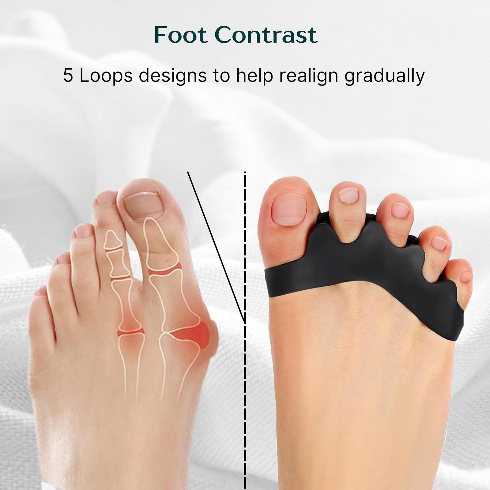 Роздільники для пальців ніг Wonder Care силіконові гелеві подушечки, фото №5