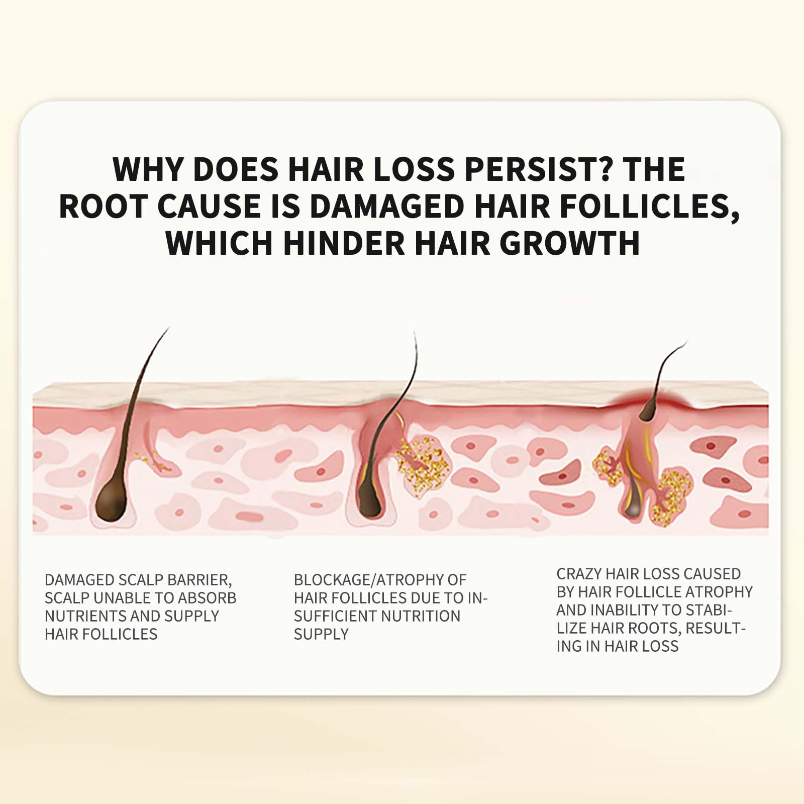 Шампунь Ginger Plant Extract Anti-Hair Loss против выпадения и для укрепления волос (1 штука), фото №4