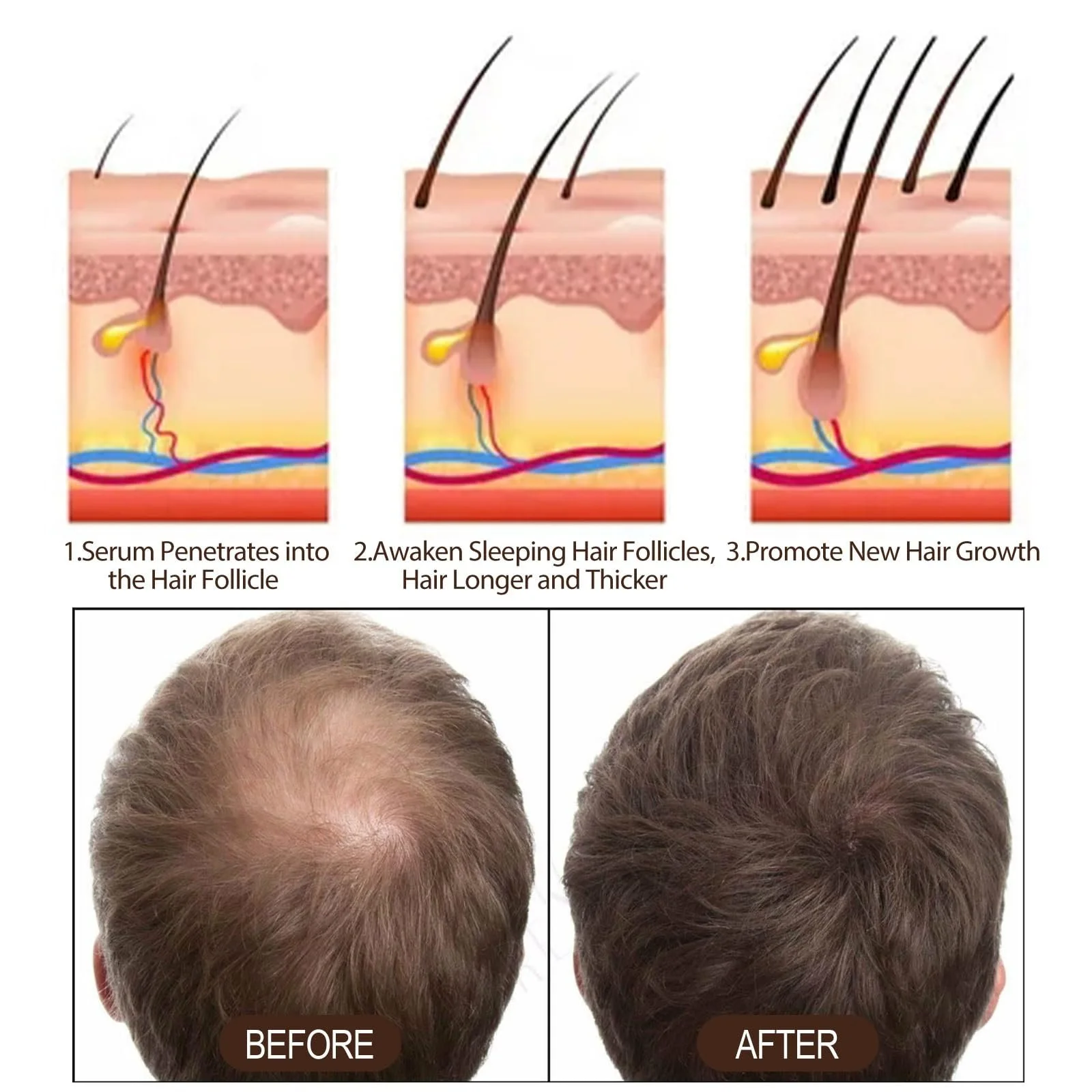 Сироватка Boxiatil Від випадіння волосся Стимулює ріст волосся - Упаковка з 2 сироваток для росту волосся, фото №5