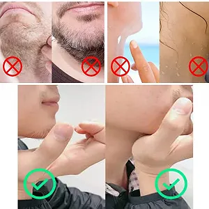 Магнітні наклейки проти хропіння synthetic.ua - Фото 1