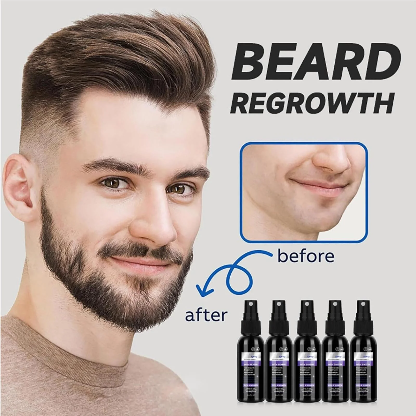 Спрей Сироватка для росту волосся для жінок та чоловіків, сироватка для волосся 5% з біотином та ніацинамідом, фото №3 Спрей Сироватка для росту волосся для жінок та чоловіків, сироватка для волосся 5% з біотином та ніацинамідом, фото №3