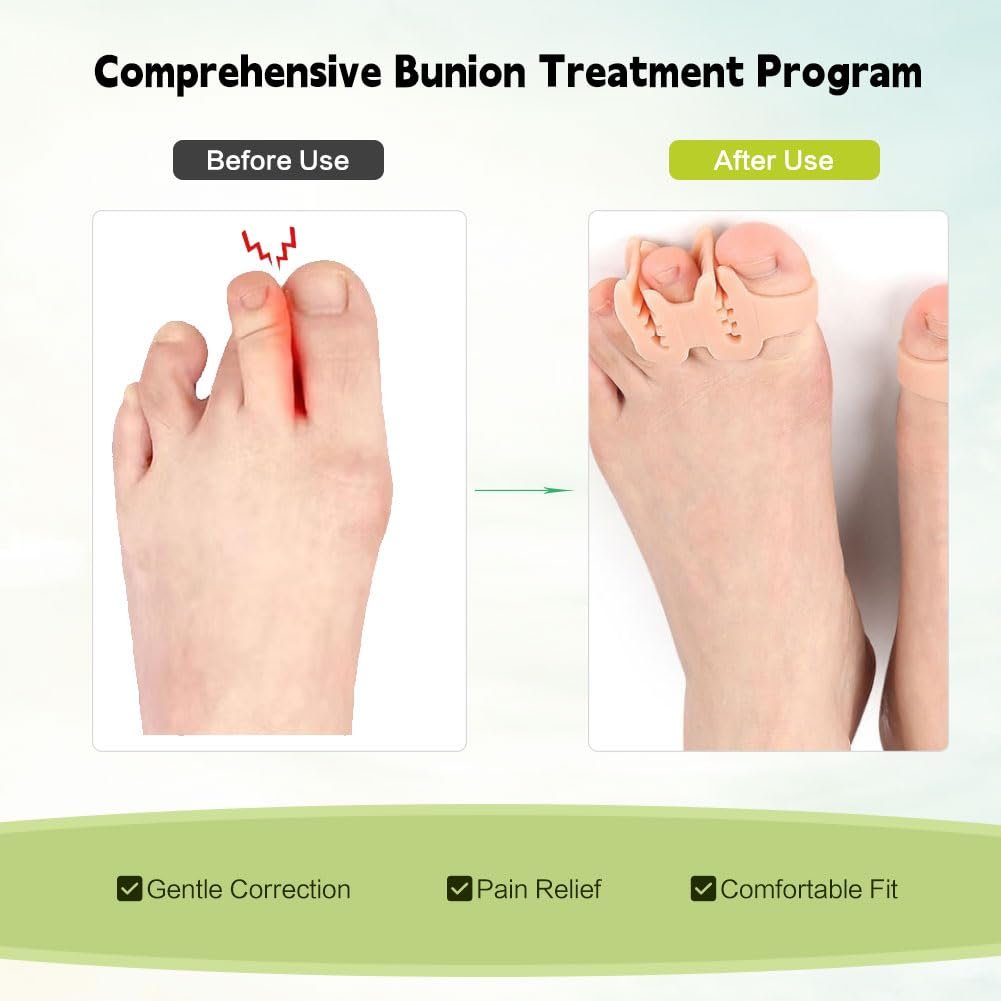 Роздільник для пальців ніг Качкодзьобий з двома отворами 6 шт Жовтий, фото №3