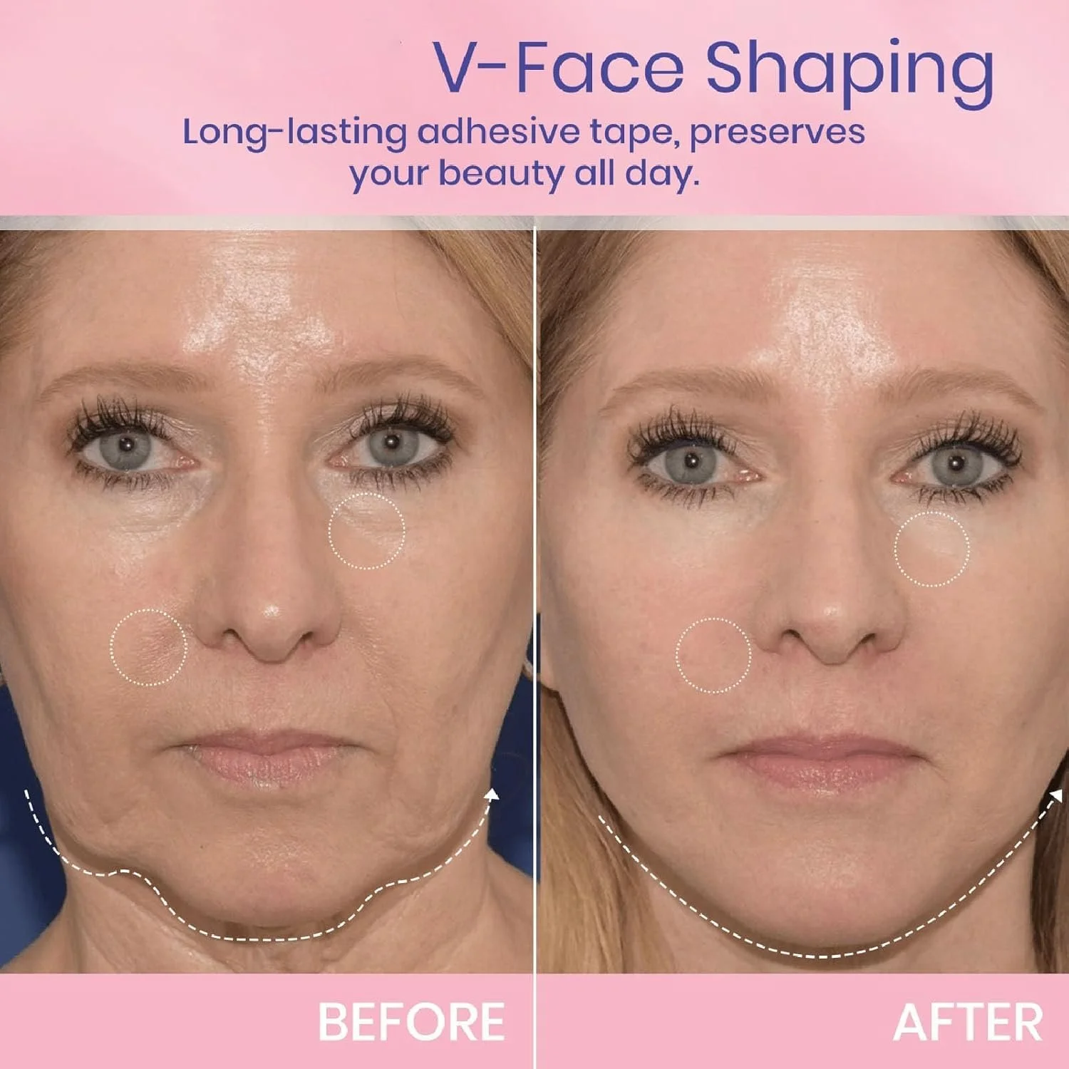 Стрічка для підтяжки обличчя Evaberry, Стрічка для схуднення обличчя, Невидима, фото №5