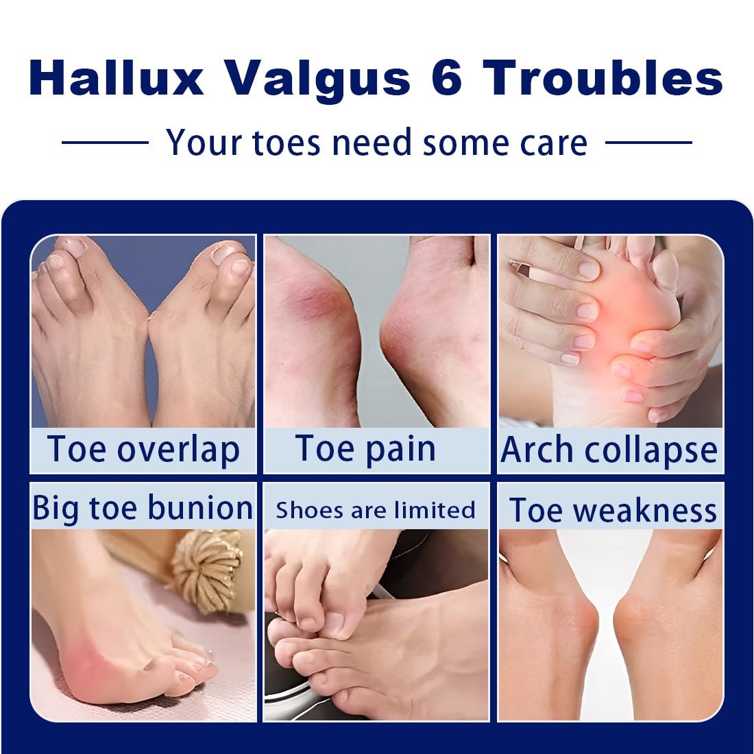Шкарпетки Hallux Valgus (2 шт.) з силіконовими подушечками. Універсальний розмір для денного та нічного використання., фото №3