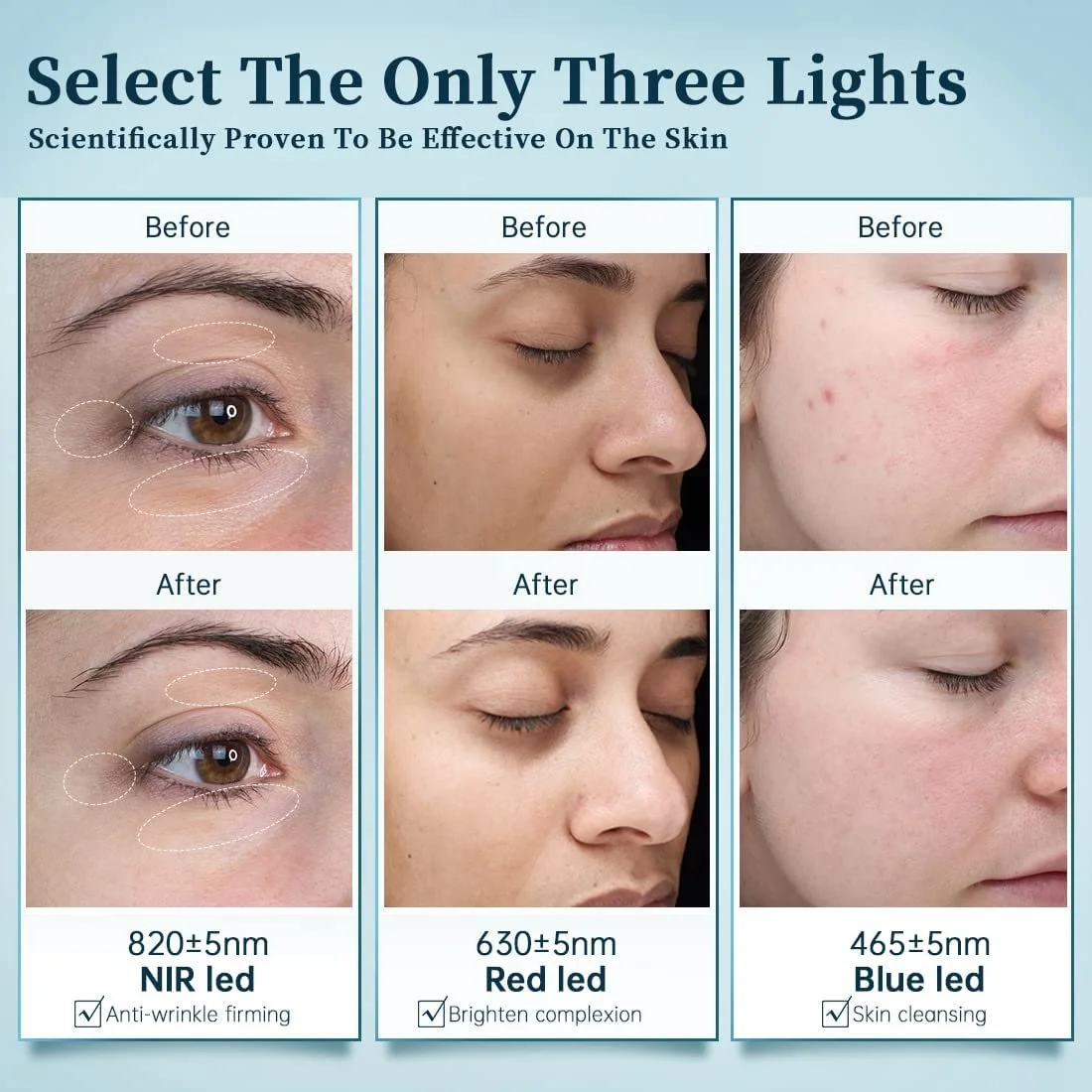 LED Маска GYH Cloud-SS(RB-034) Світлотерапія Червоний, фото №6