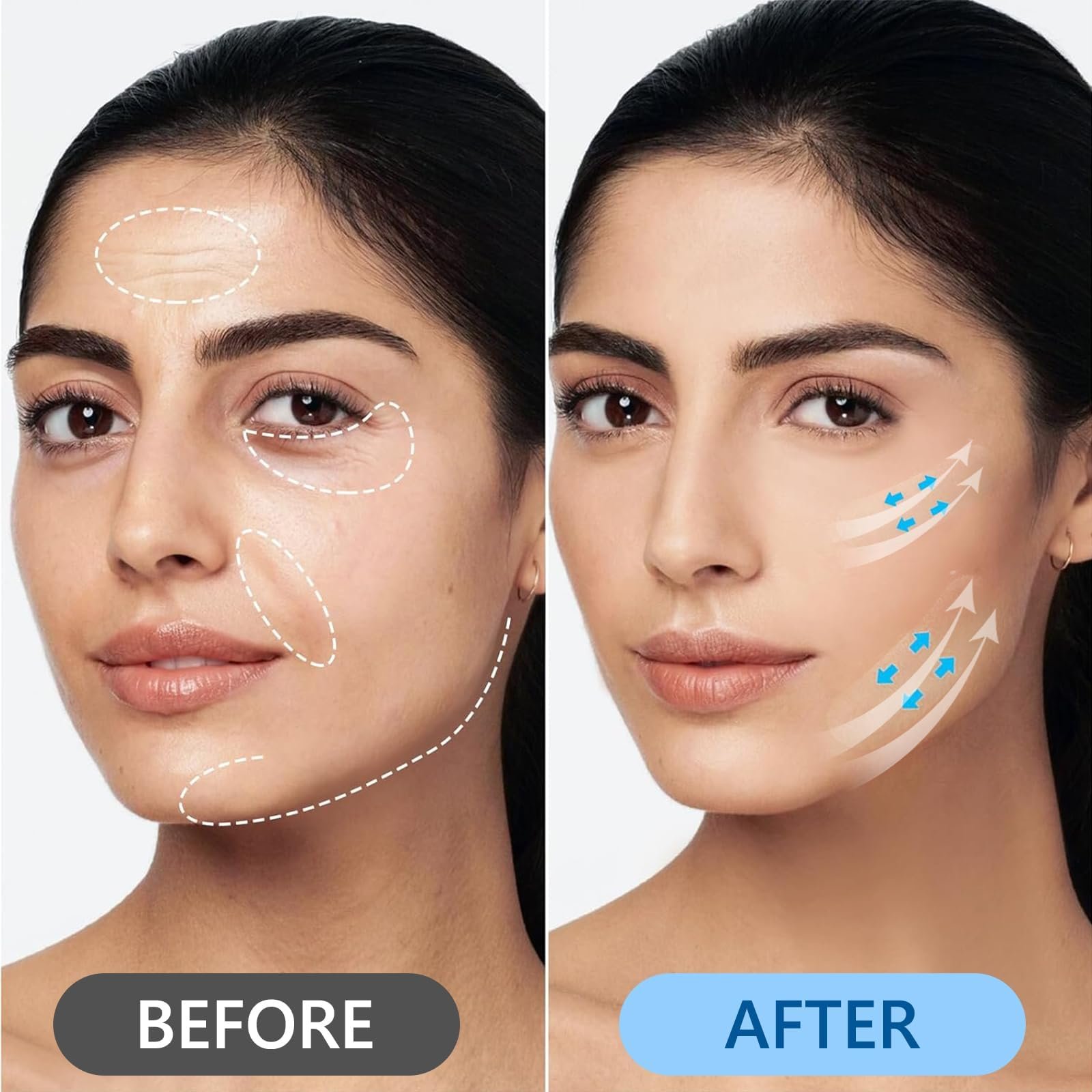 Наклейки для підтяжки обличчя 160 шт, невидимий патч для підтяжки обличчя V-форми, фото №5