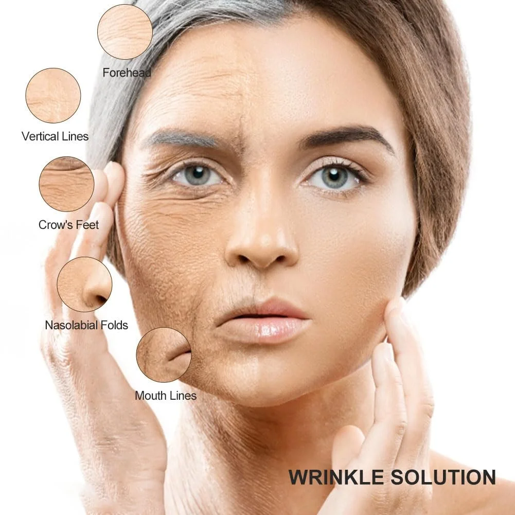 Лента для подтяжки лица Бежева, 2,5 см x 5 м, фото №8