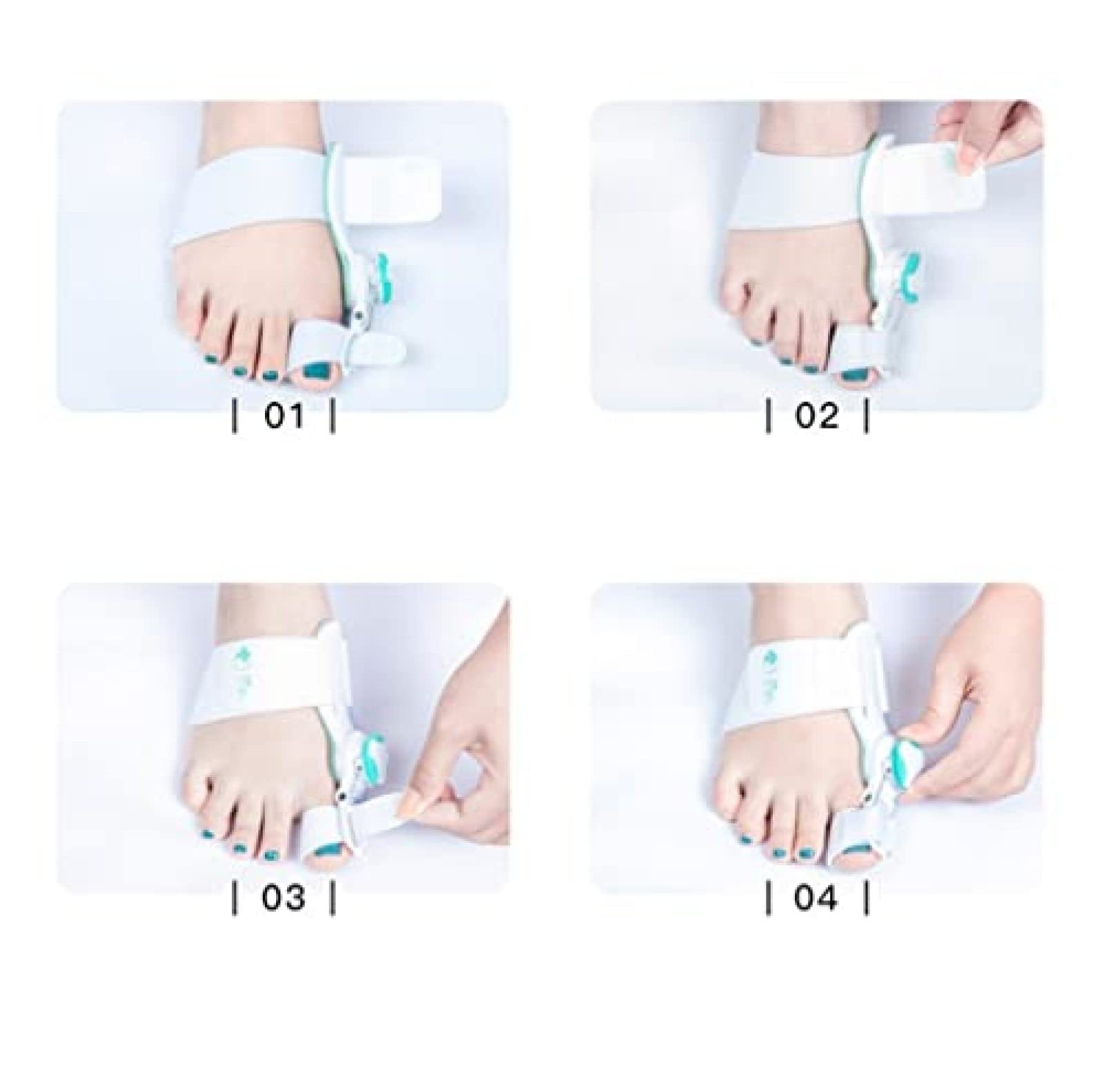 Шина для великого пальця стопи регульована, з полегшенням болю вальгусної деформації, фото №8