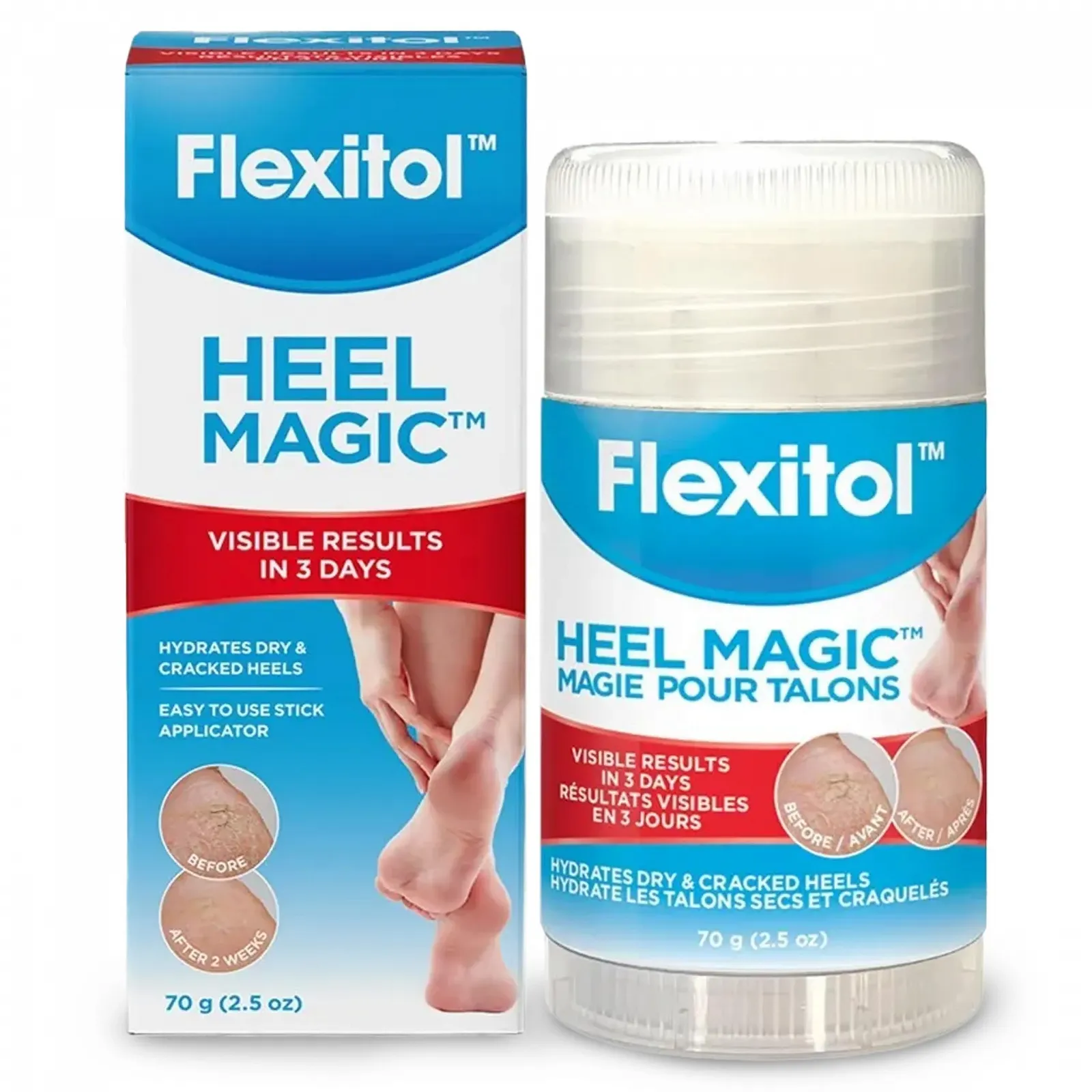 Средство для пяток Flexitol Heel Magic с маслом ши и витамином E 2,5 унции, фото №1