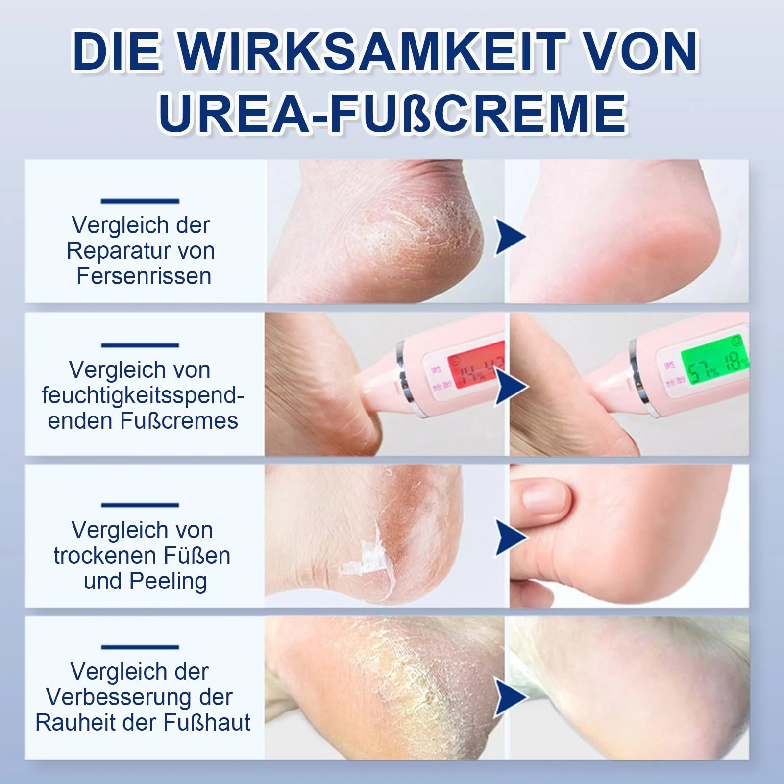 Крем восстанавливающий Urea 60% 200 г, фото №6