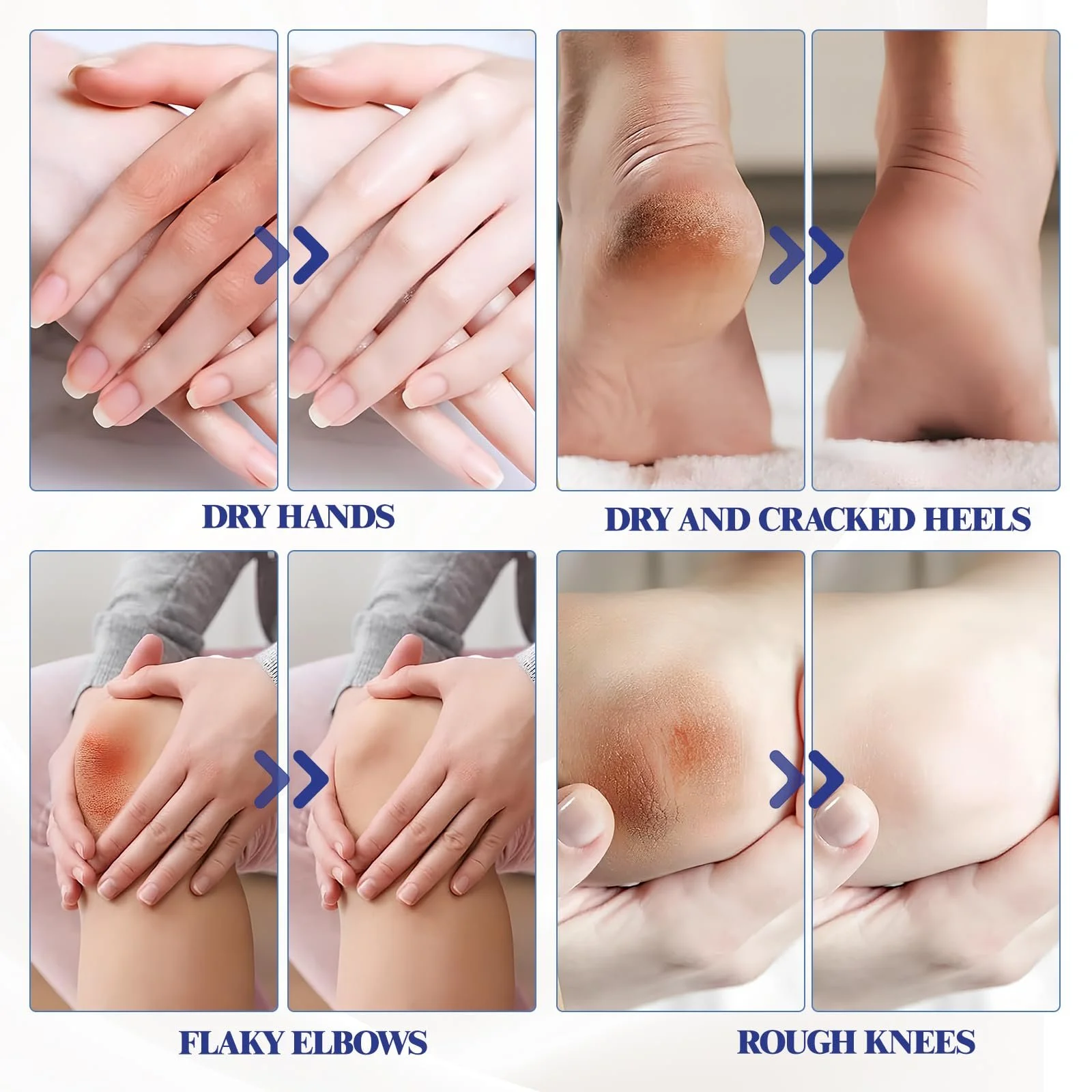 Крем для ног Summer foot Набор 2 шт. для очень сухой кожи с персиком и авокадо и 10 масками для ног, фото №4