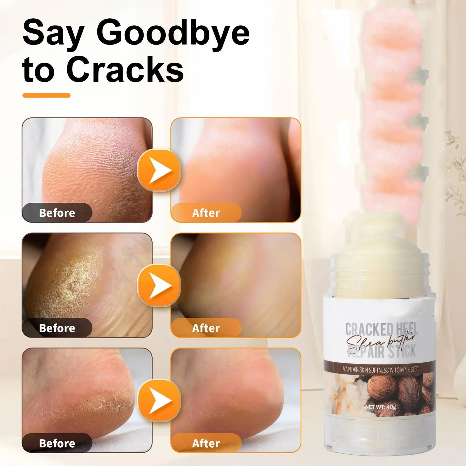 Стік-бальзам для ніг Intensive Nourishing Urea інтенсивний зволожувальний для дуже сухої шкіри., фото №2