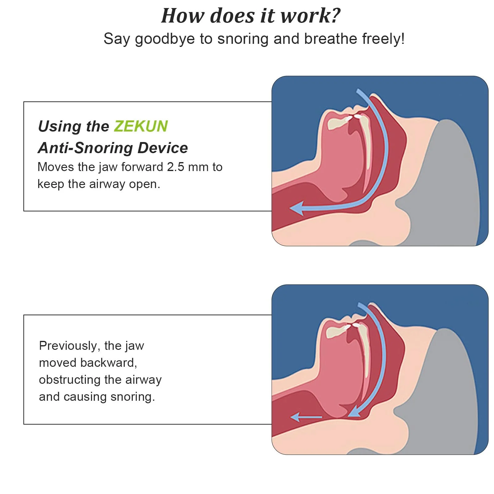 Щипцы от храпа Comfort для мужчин и женщин, фото №3