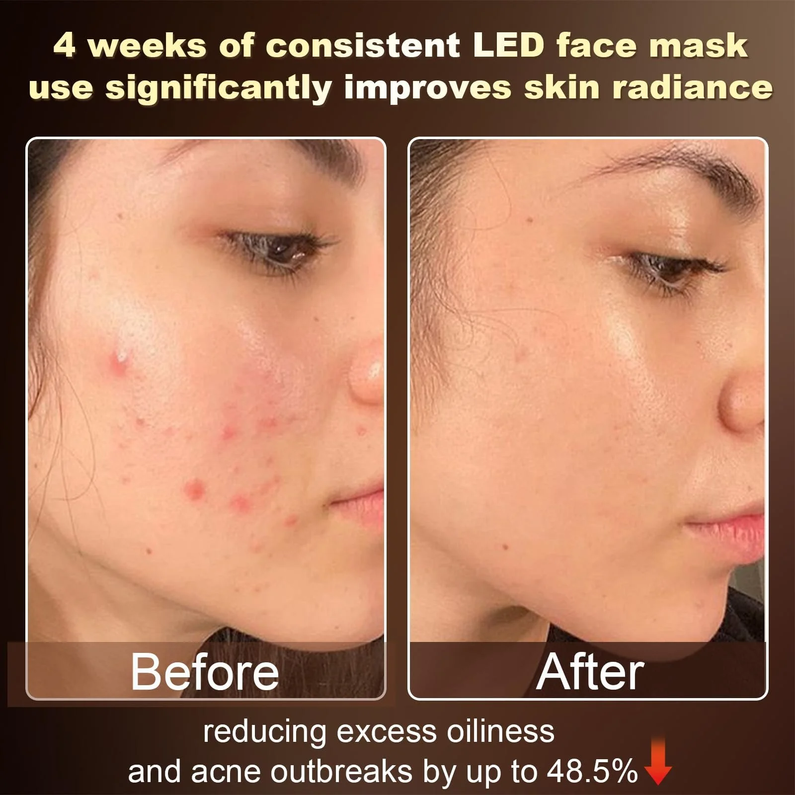 LED Маска для лица Rkdely 7 цветов, Беспроводная, Маска для лица с красным светом, фото №5 LED Маска для лица Rkdely 7 цветов, Беспроводная, Маска для лица с красным светом, фото №5