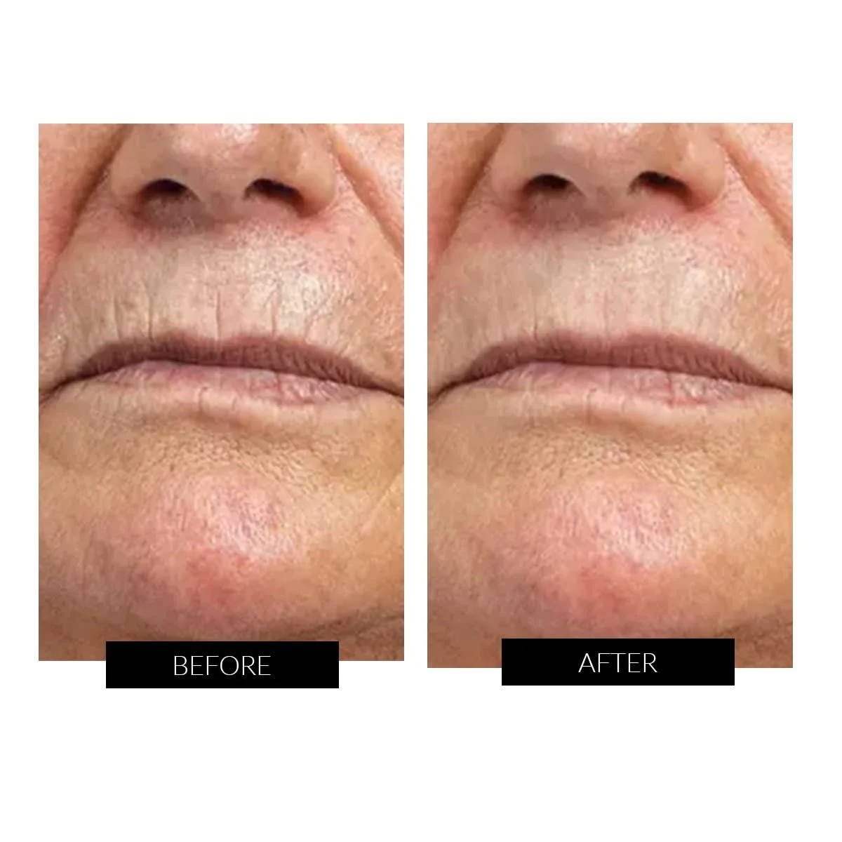 Високочастотний прилад для обличчя CurrentBody Skin, фото №4