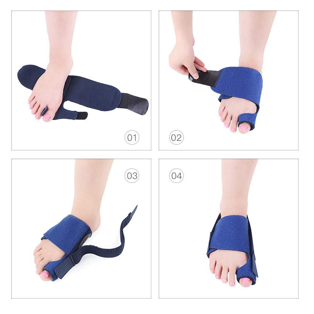 Коректор великого пальця стопи Пара Hallux Valgus Шини для випрямлення пальців ніг Знеболення, фото №9
