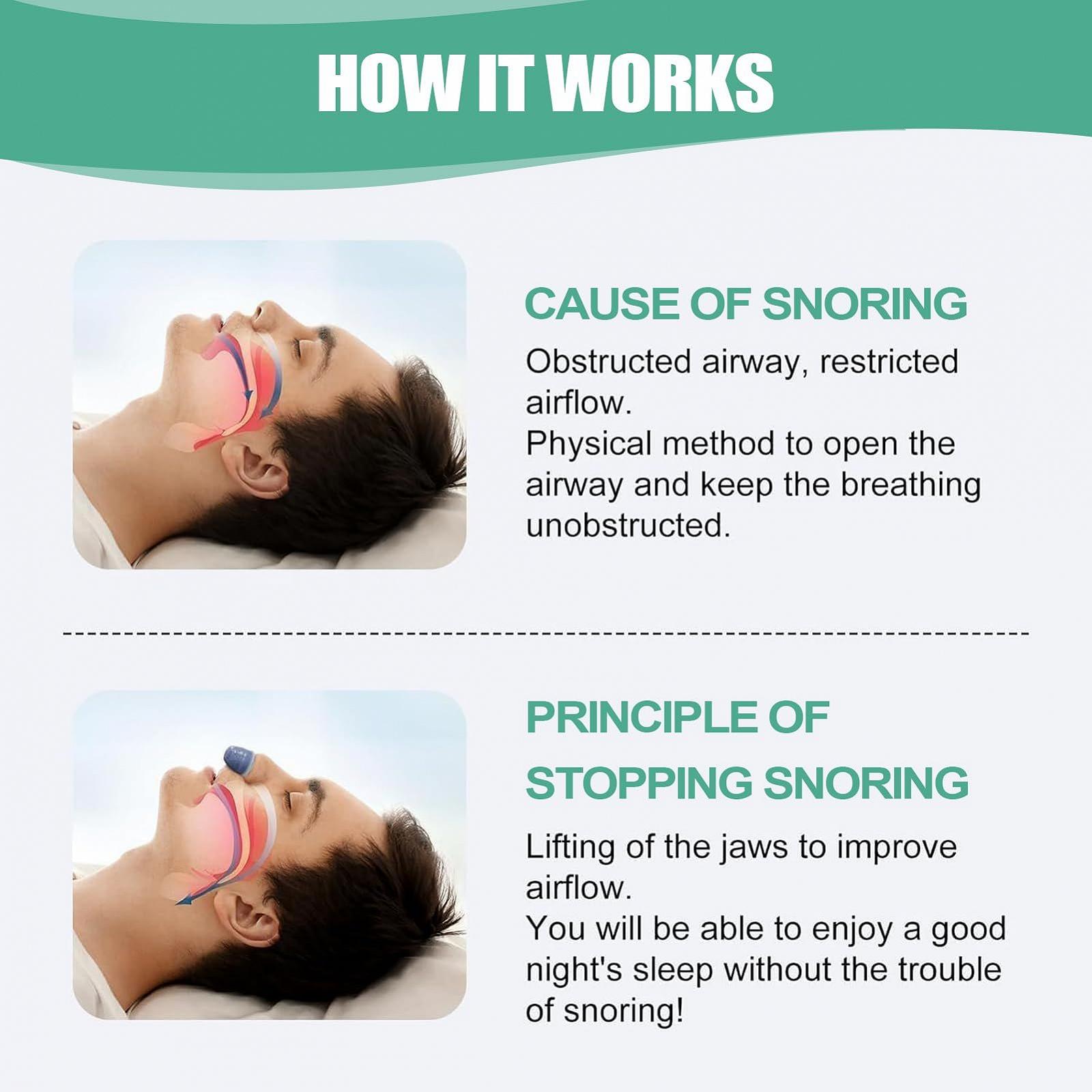 Пристрій проти хропіння для глибокого та спокійного сну Active Quiet Sleep Aid для розладів нічного сну, фото №2