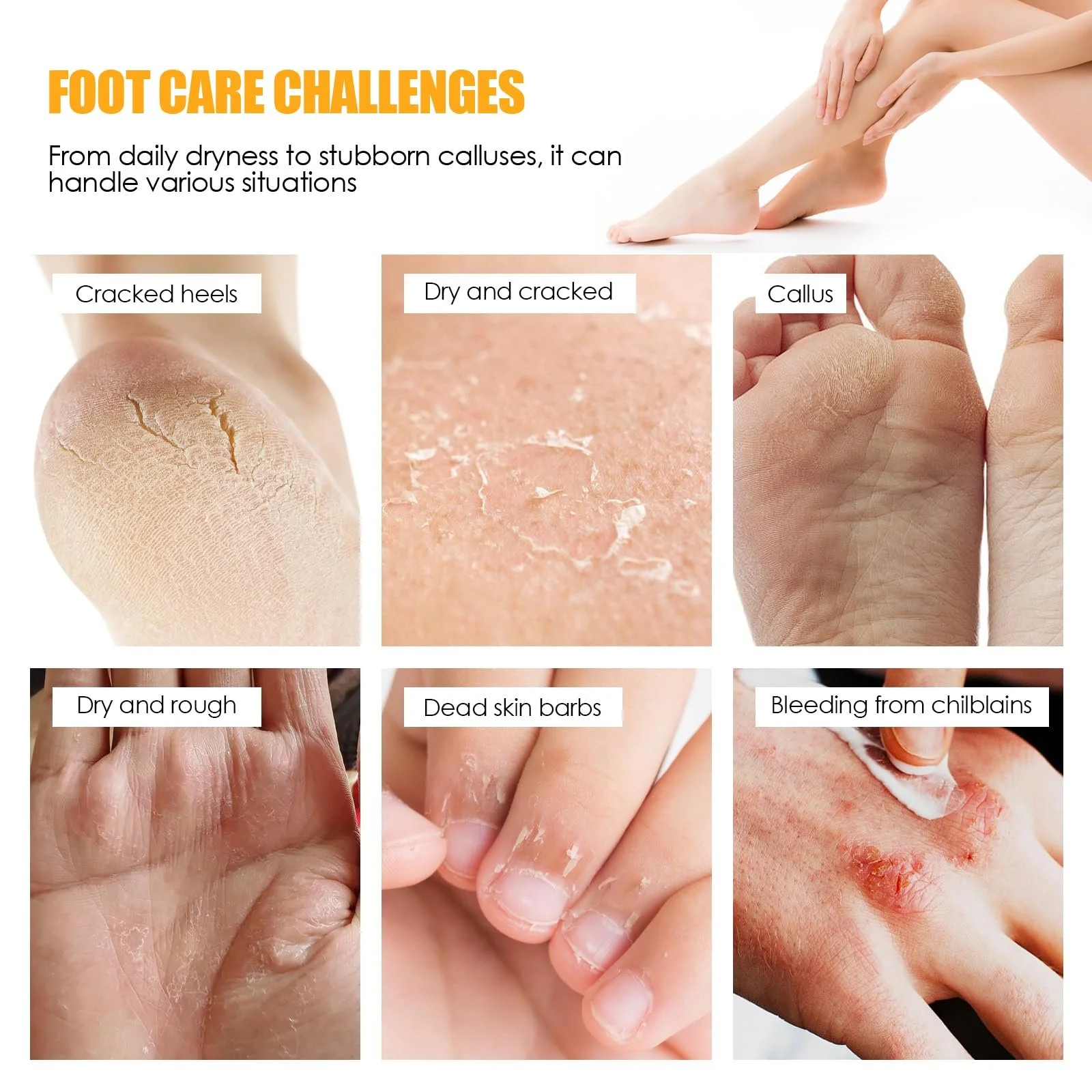 Крем для ног увлажняющий против трещин с 60% мочевины, фото №5 Крем для ног увлажняющий против трещин с 60% мочевины, фото №5