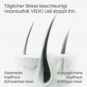 Эликсир для кожи головы VEDIC LAB Energizing Day + UV (100 мл) Сыворотка против выпадения волос с аюрведическими травами и швейцарскими биотехнологиями - Питательный и защитный уход за кожей головы для более сильных и густых волос synthetic.ua - Фото 1