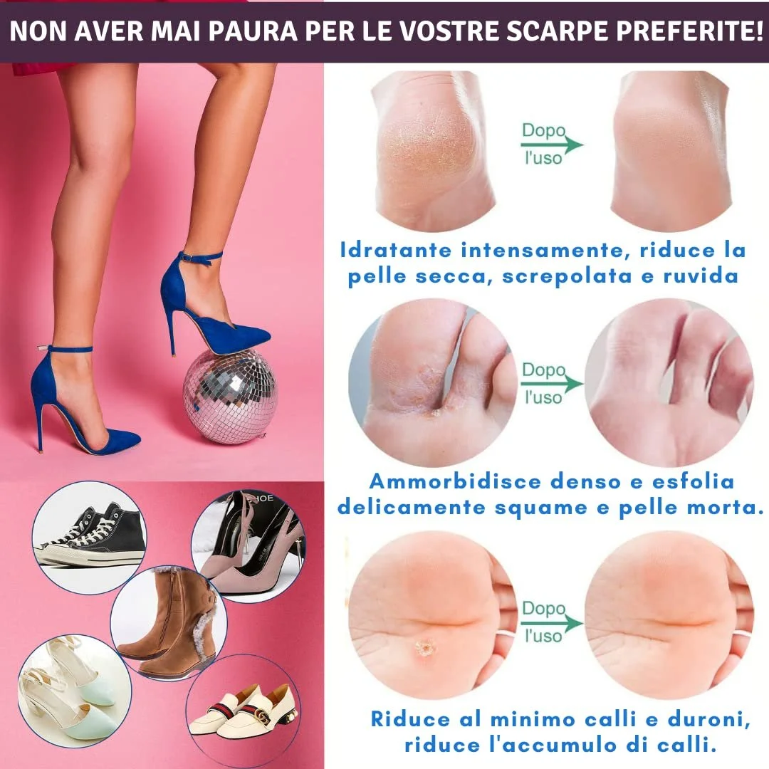 Крем с мочевиной 30% Eladerm 100 мл, фото №5 Крем с мочевиной 30% Eladerm 100 мл, фото №5