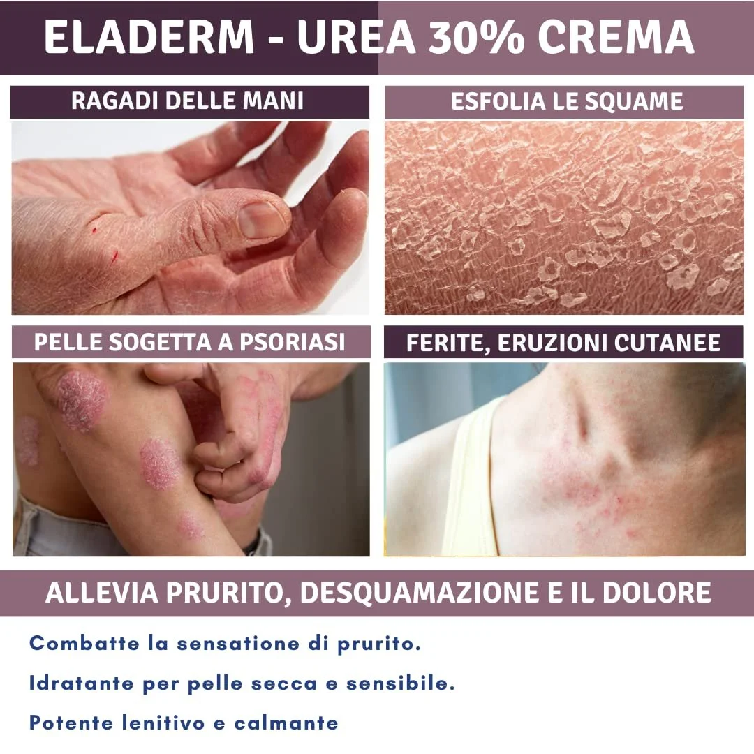 Крем с мочевиной 30% Eladerm 100 мл, фото №6 Крем с мочевиной 30% Eladerm 100 мл, фото №6