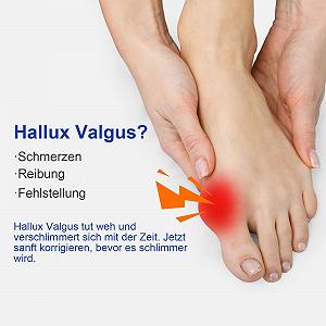 Шина для корекції Hallux Valgus, набір для корекції вальгусної деформації великого пальця стопи synthetic.ua - Фото 1