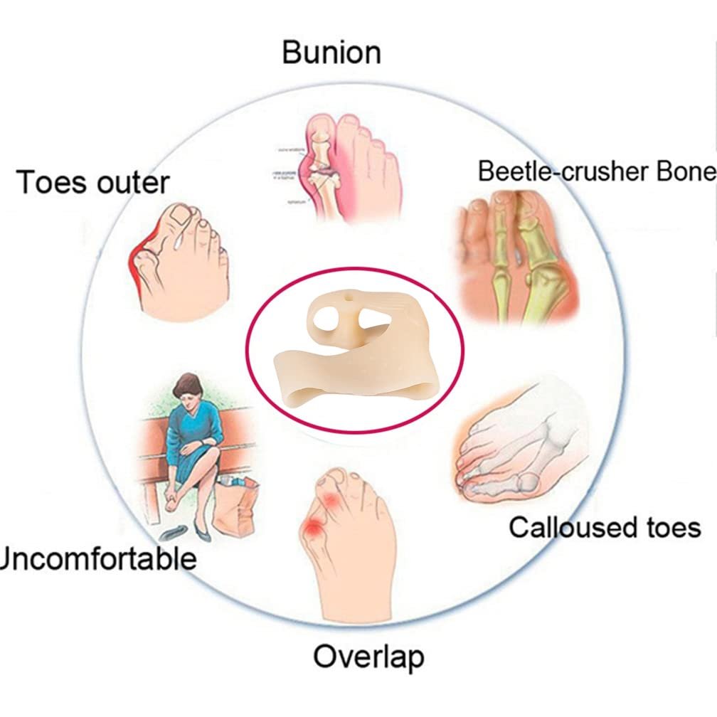 Коректор великого пальця стопи Без бренду Роздільник пальців, Знеболювальний, фото №2