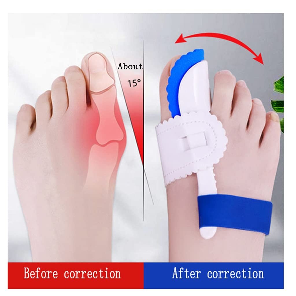 Шина для большого пальца ноги от вальгусной деформации, фото №4 Шина для большого пальца ноги от вальгусной деформации, фото №4
