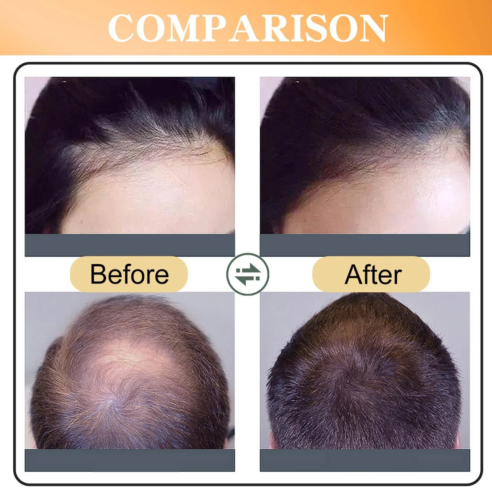 Спрей для росту волосся, Сироватка для росту волосся, фото №6