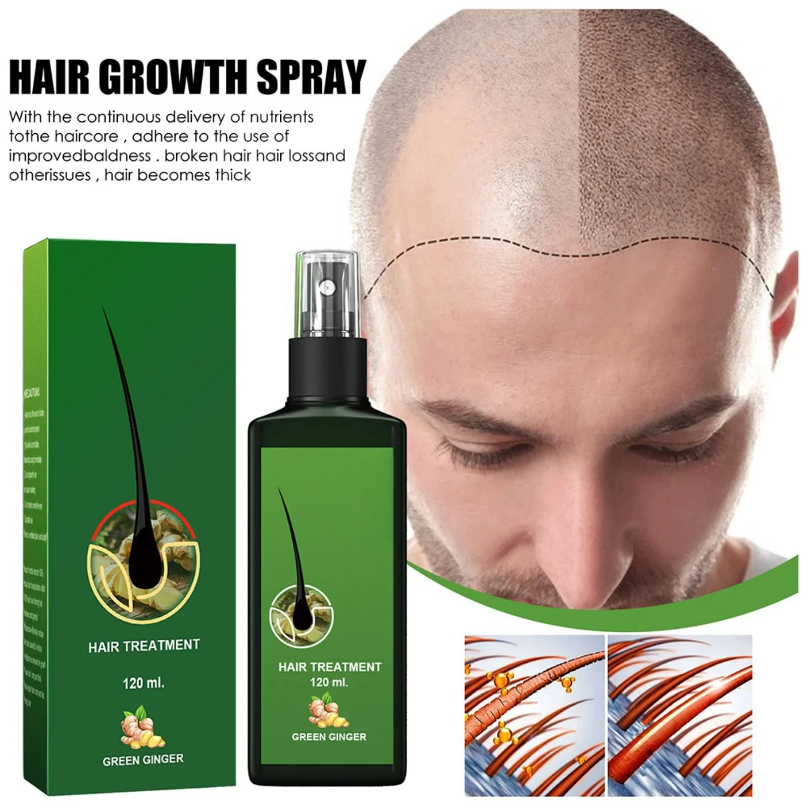 Сироватка для росту волосся Qiaogeli для стоншеного волосся, фото №4 Сироватка для росту волосся Qiaogeli для стоншеного волосся, фото №4