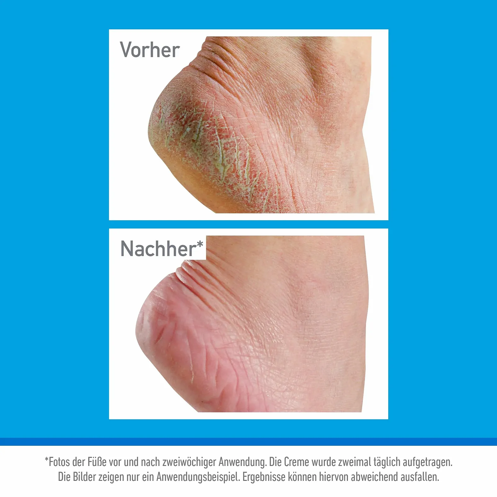 Крем для ног в тюбике O'Keeffe's Healthy Feet 80 мл, фото №4