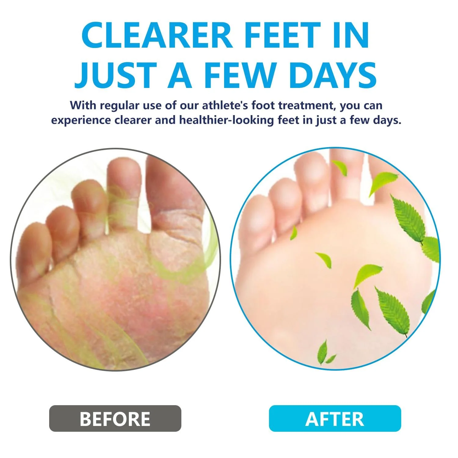 Гель для ног против грибка, зуда и запаха натуральный 2 шт., фото №2 Гель для ног против грибка, зуда и запаха натуральный 2 шт., фото №2